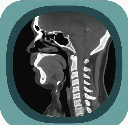 CT neck anatomy icon